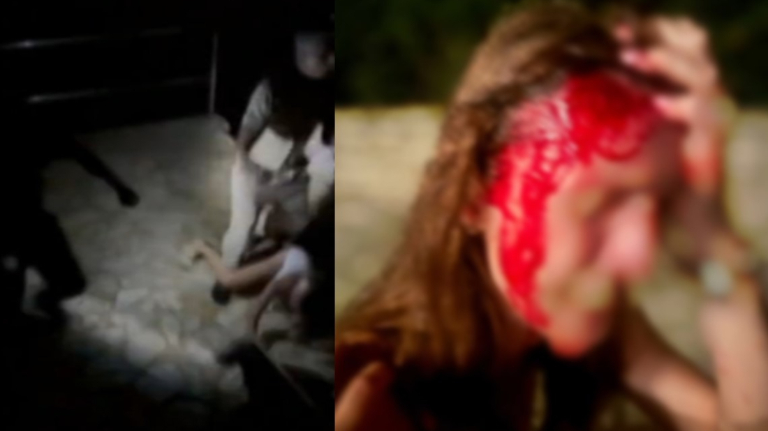 VIDEO Jezive scene s plaže u Savudriji: Zaštitari na plaži pretukli mlade Slovence