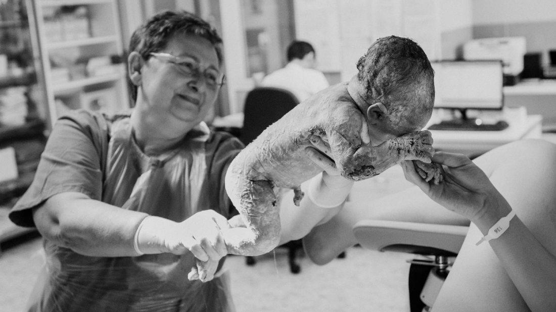 „Novi život se rađa“: Intimna fotoizložba Suzane Bote stiže u rovinjsku Galeriju Batana