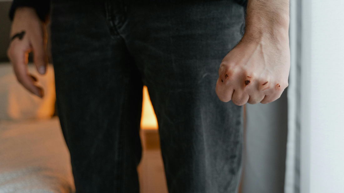 SLUČAJ NASILJA U ISTRI: Pretukao djevojku pa završio iza rešetaka, 25-godišnjaku određen istražni zatvor