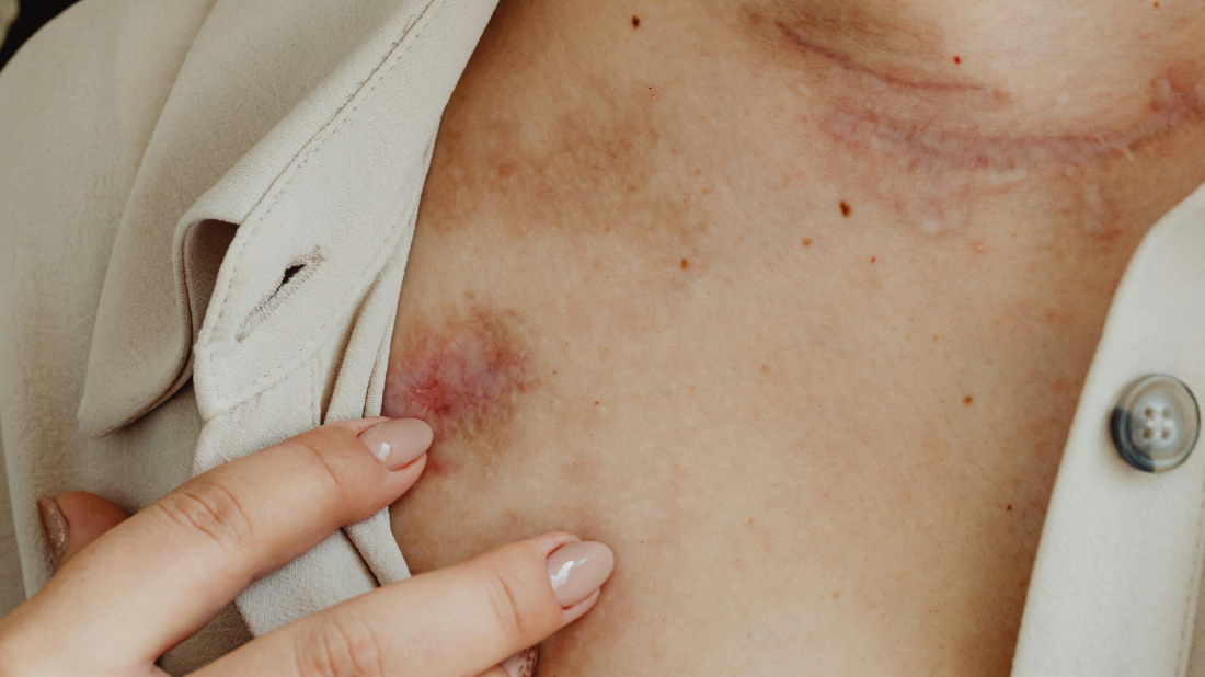 Butigan o nasilju nad ženama: 'Sustav postoji da bi zaštitio, a prijava je početak sigurnosti'