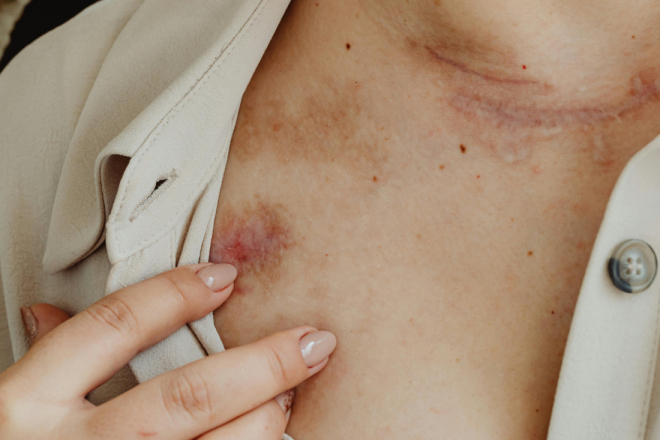 Butigan o nasilju nad ženama: 'Sustav postoji da bi zaštitio, a prijava je početak sigurnosti'