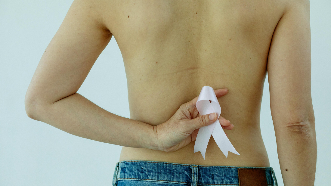 Zabrinjavajuće brojke: U Istri svake godine od raka dojke oboli oko 175 žena