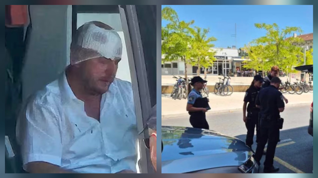 Taksist fizički napao vozača FlixBusa u Rovinju, intervenirala policija