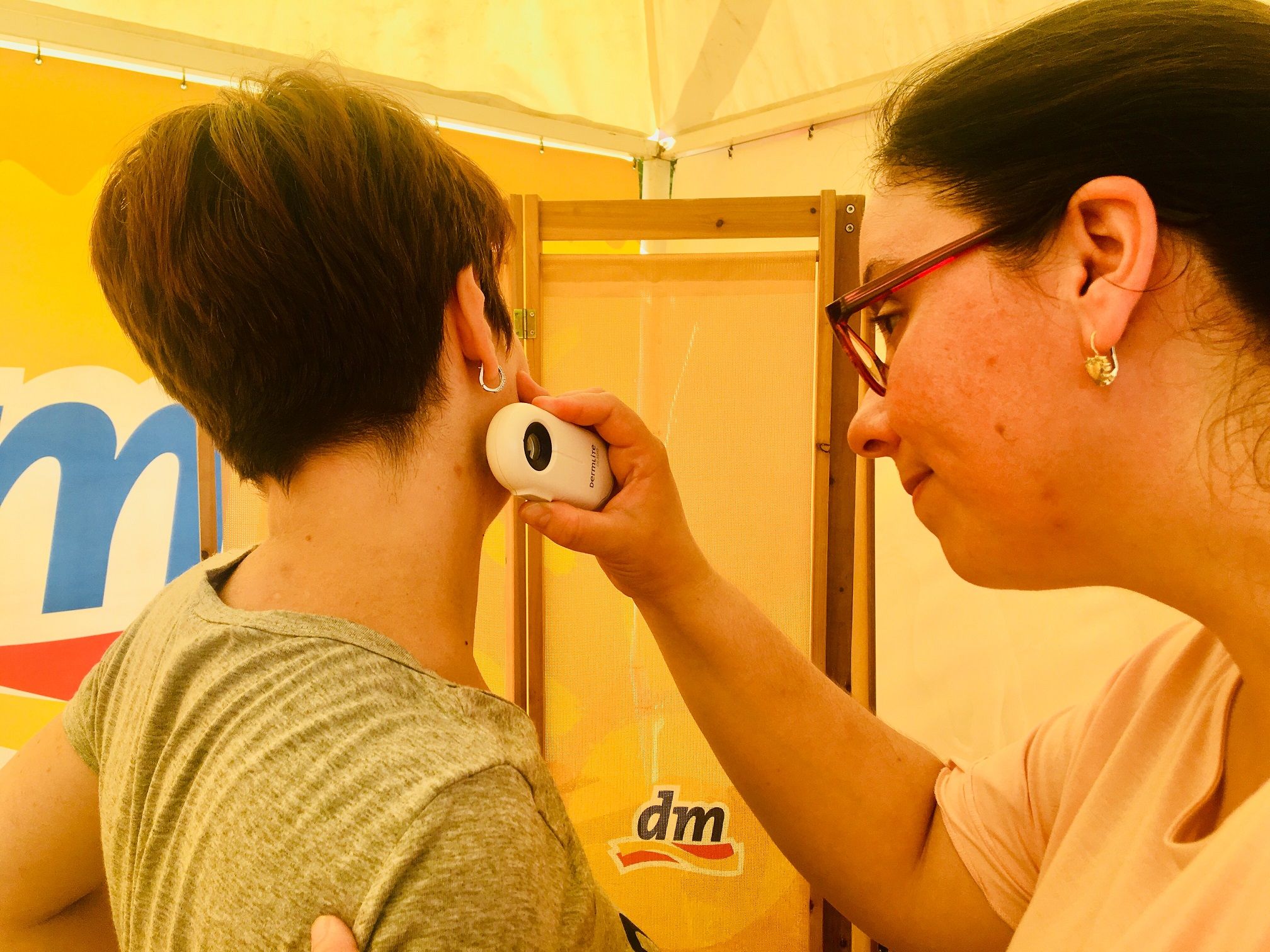 SPRIJEČITE MELANOME U nedjelju besplatni pregled kože na pulskoj Puntiželi 