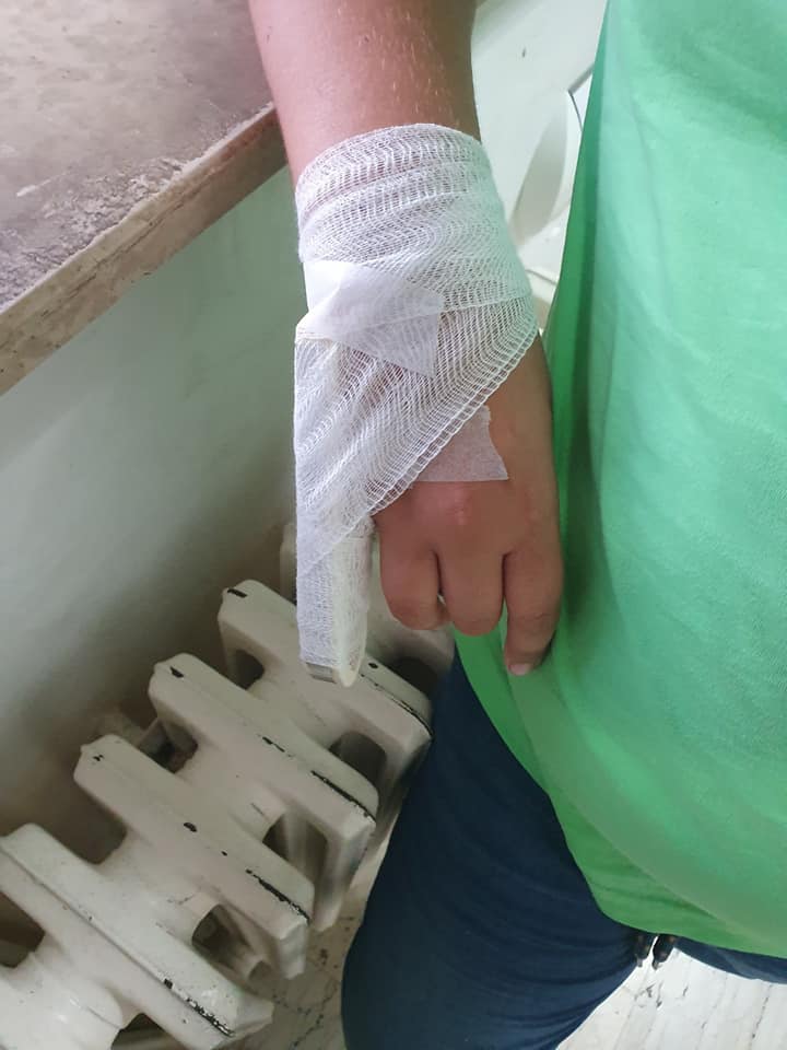 STRAŠNO NASILJE U ŠKOLI!  Petaša ozlijedio učenik 7. razreda