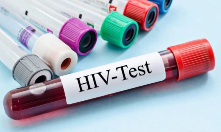 Počinje obilježavanje tjedna testiranja na na HIV, virusne hepatitise i spolno prenosive infekcije