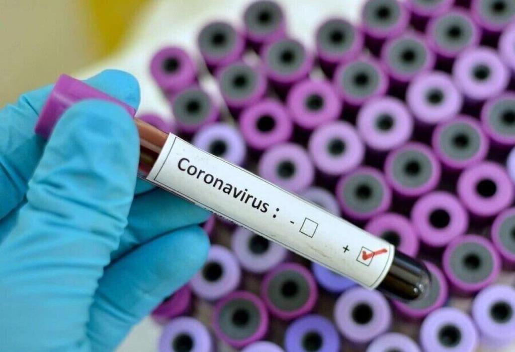 Stigli novi rezultati: Još četiri osobe pozitivne! U ISTRI DO SADA 30 OBOLJELIH OD KORONAVIRUSA