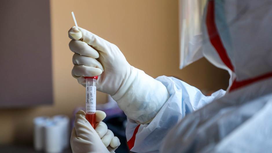 Još 9 osoba hospitalizirano u OB Pula