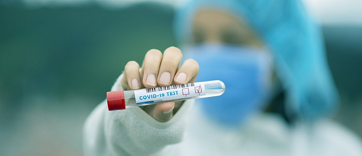 Slovenska vlada proglasila epidemiju za cijelu državu