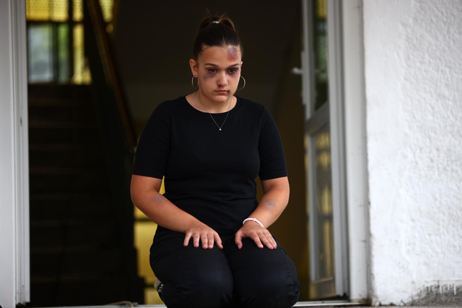 STOP NASILJU NAD ŽENAMA! U Istri ubijene 22 žene, Sigurna kuća Istra osigurala utočište za njih 312